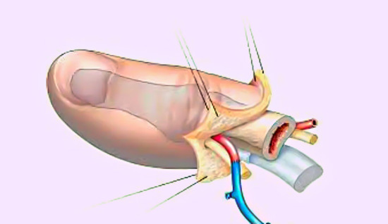Finger and Limb Amputations