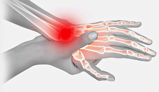 Scaphoid Fractures